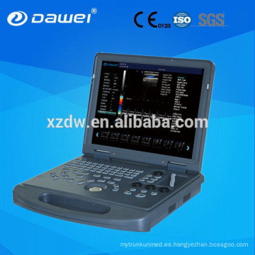 DW-C60 maquina ecografia y laptop ultrasonido doppler color